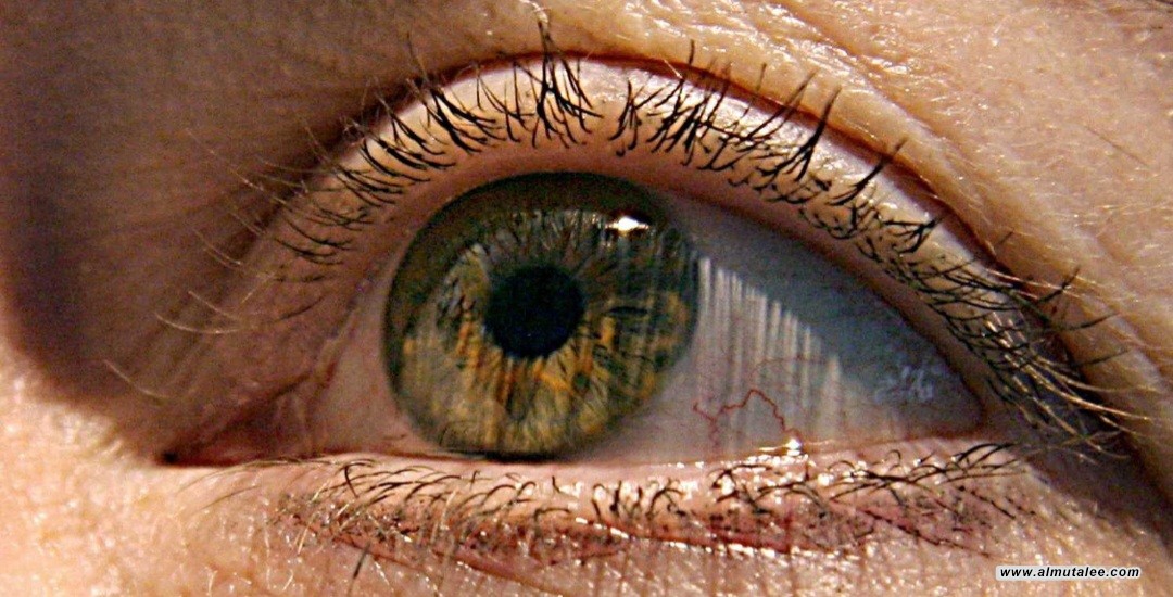 post-image
